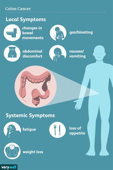 colon cancer specific symptoms